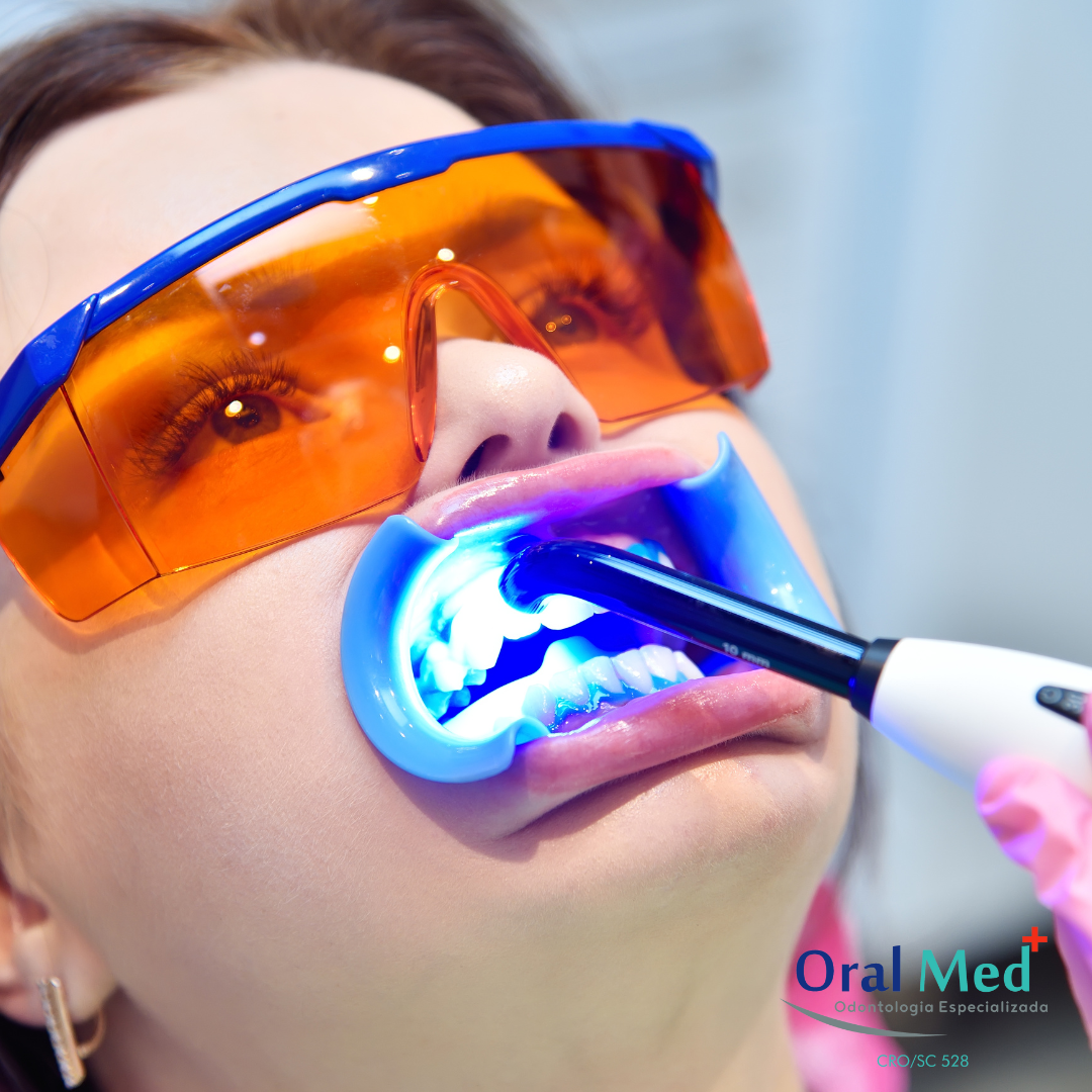 Clareamento Dental A Laser OralMed Odontologia Especializada