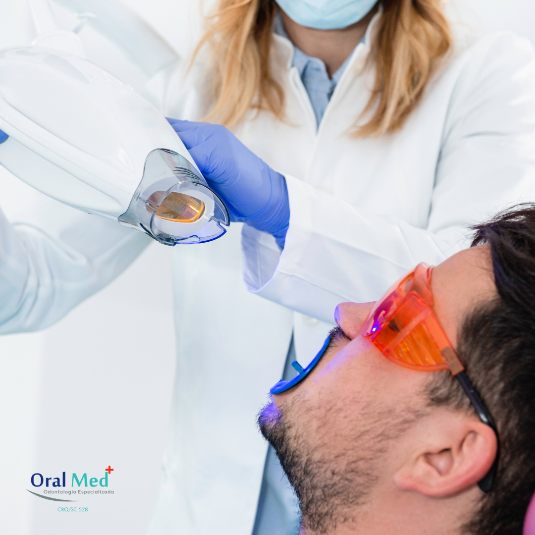 Mitos E Verdades Sobre O Clareamento A Laser Oralmed Odontologia