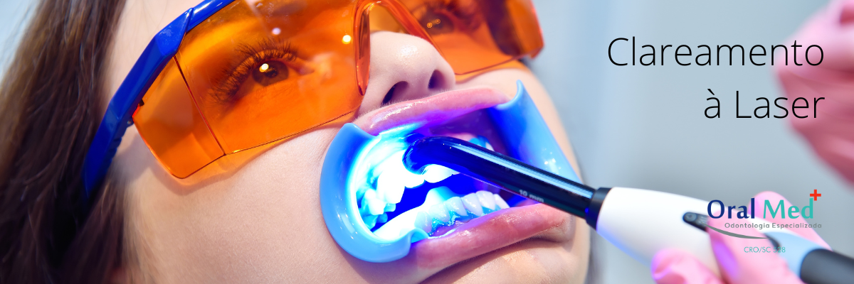 OralMed Odontologia Especializada - Clareamento Dental a Laser